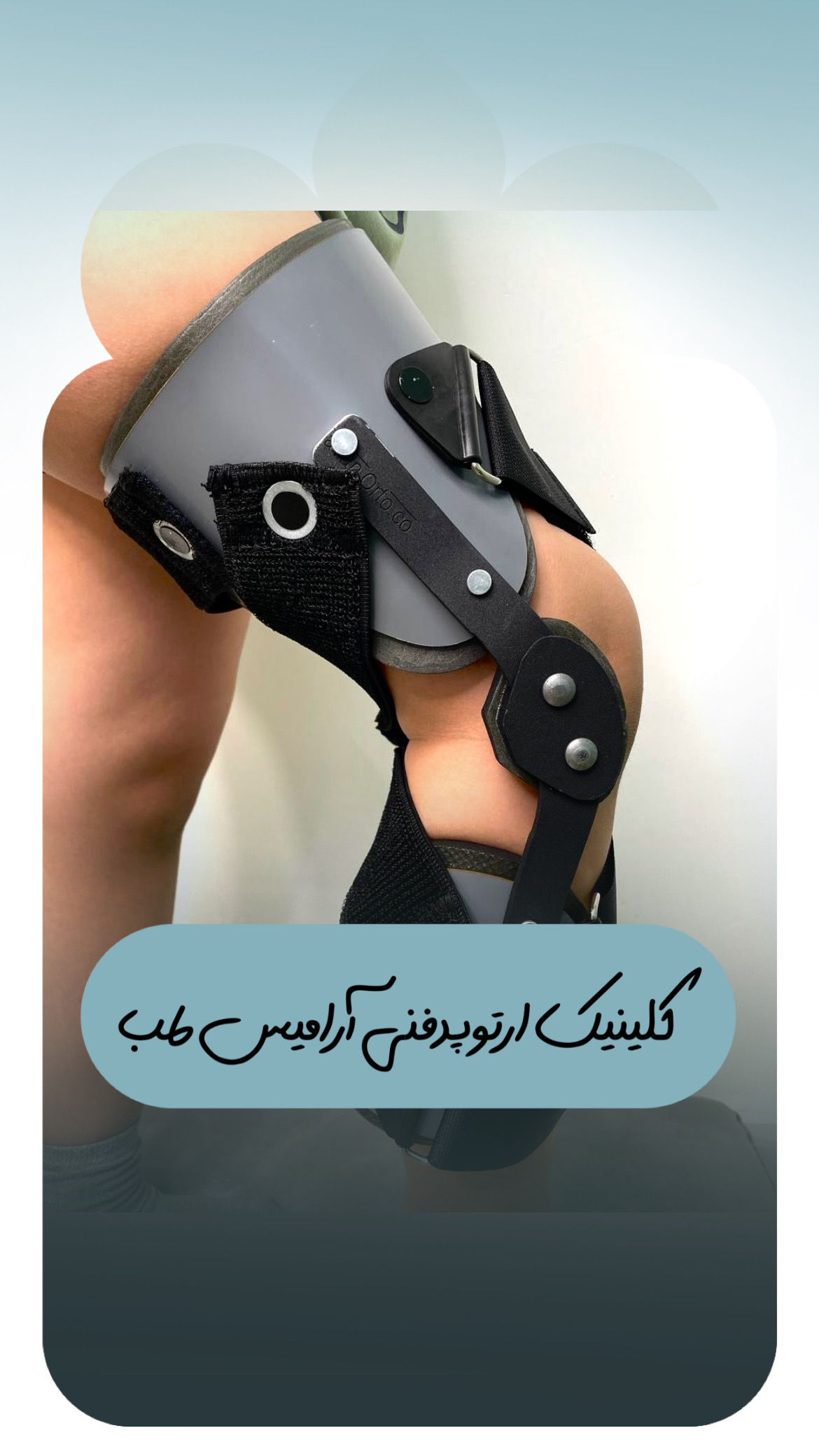 درمان پای پرانتزی غرب تهران