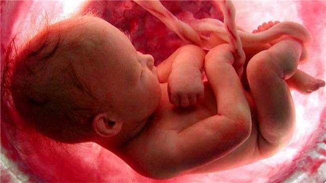 با طرح جدید مجلس درباره سقط جنین،”۷۰ هزار ناهنجاری” گریبان مردم را خواهد گرفت